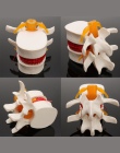 Szkielet anatomii człowieka kręgosłupa lędźwiowego przepuklina dysku model nauczania czaszki mózgu traumatyczne pistolet szkoły 